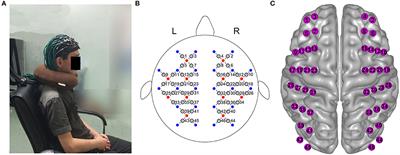 Effect of Resting-State fNIRS Scanning Duration on Functional Brain Connectivity and Graph Theory Metrics of Brain Network